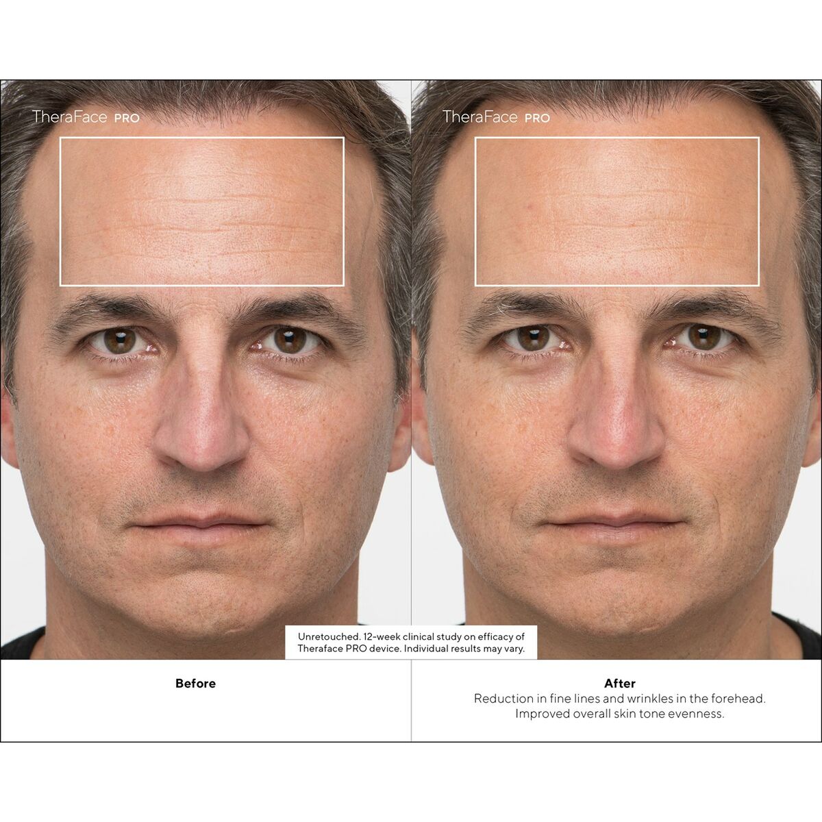 V5HF4AAD1C52DF16820D85AF27229C01803R4939060P10